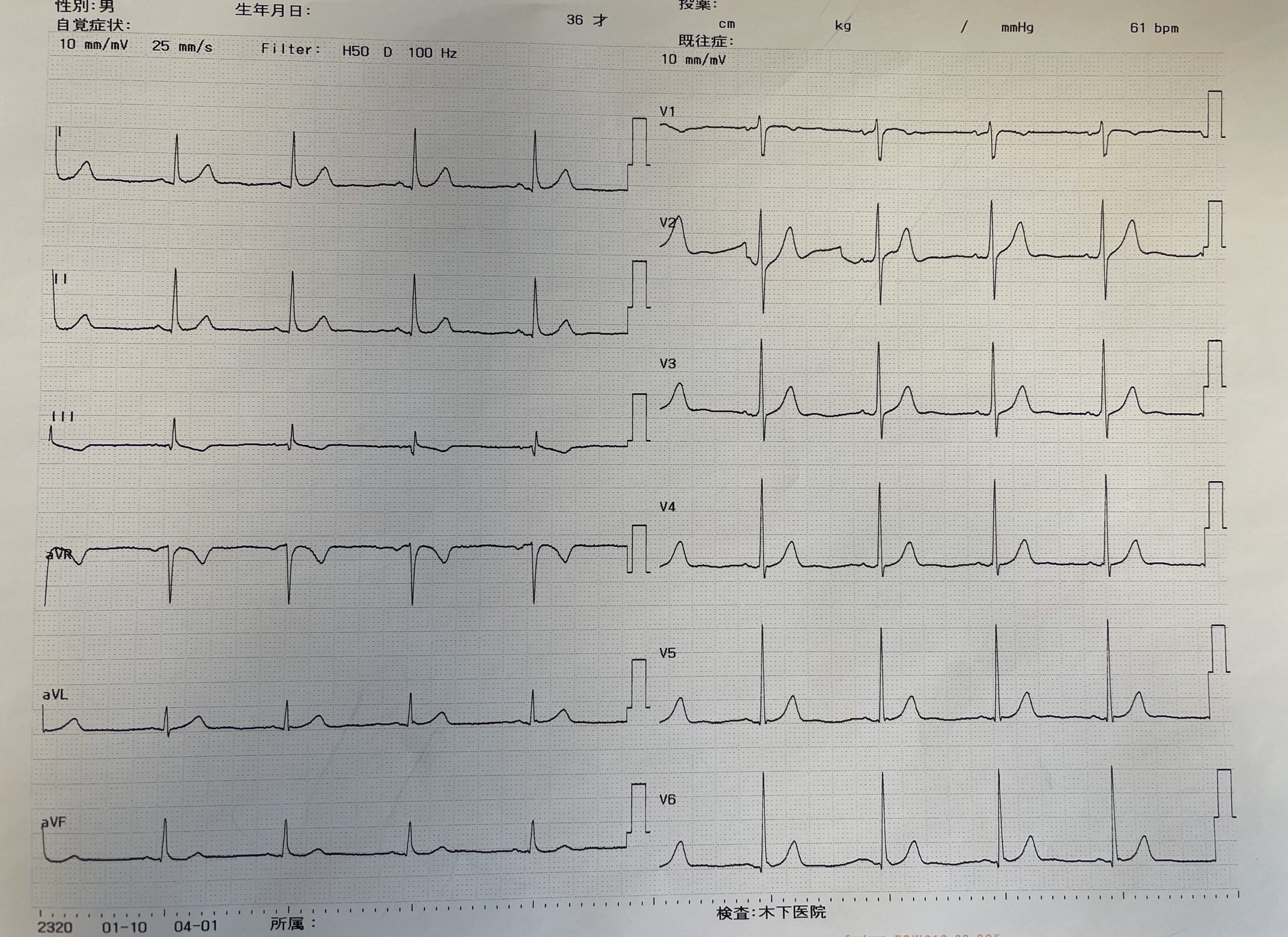 心電図の検査結果