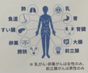 対応しているがんの種類